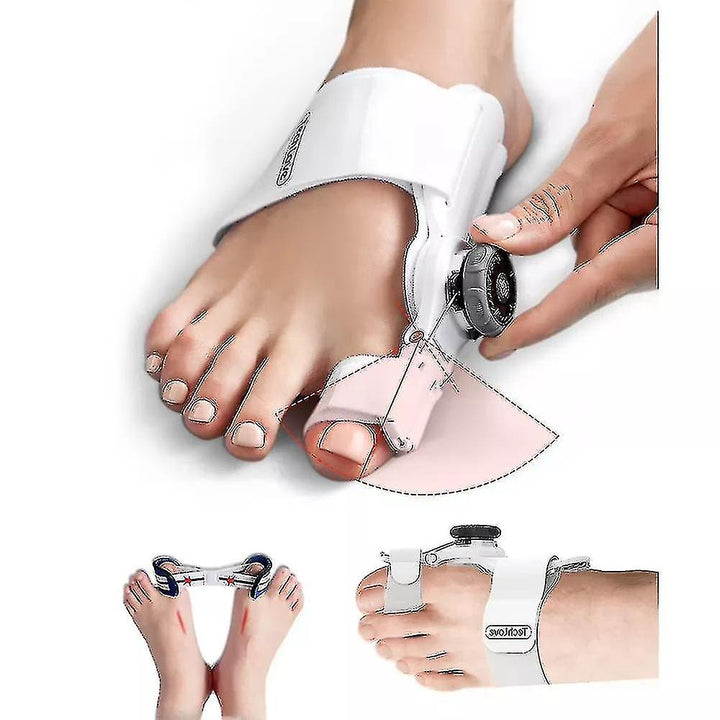 Total aligner to eliminate bunions